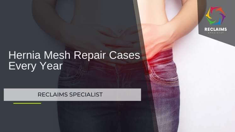 Harnia Mesh Repair Law suit Update